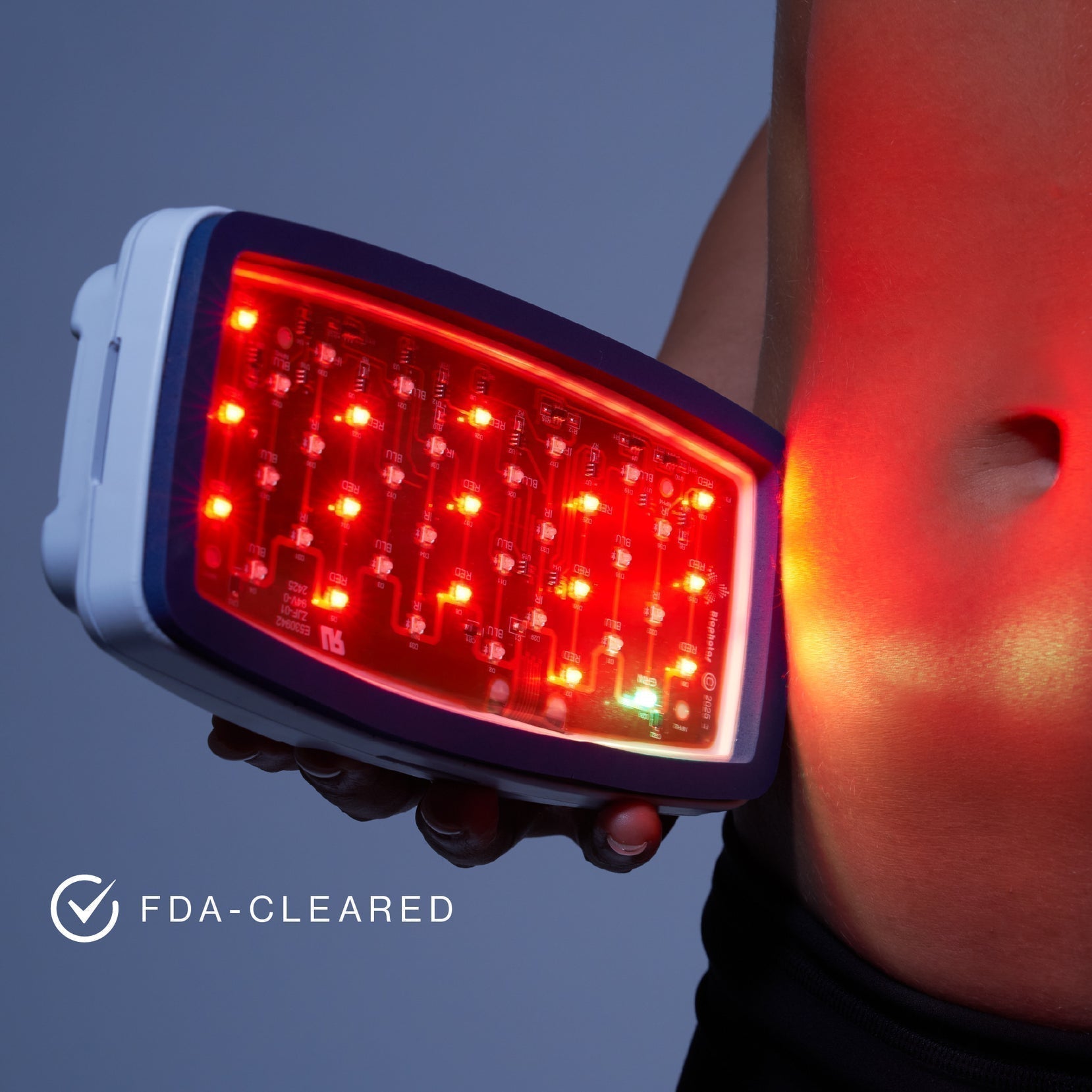 Anti-aging results showing reduced fine lines and wrinkles after 4 weeks of medical-grade red light therapy (640nm) with Celluma