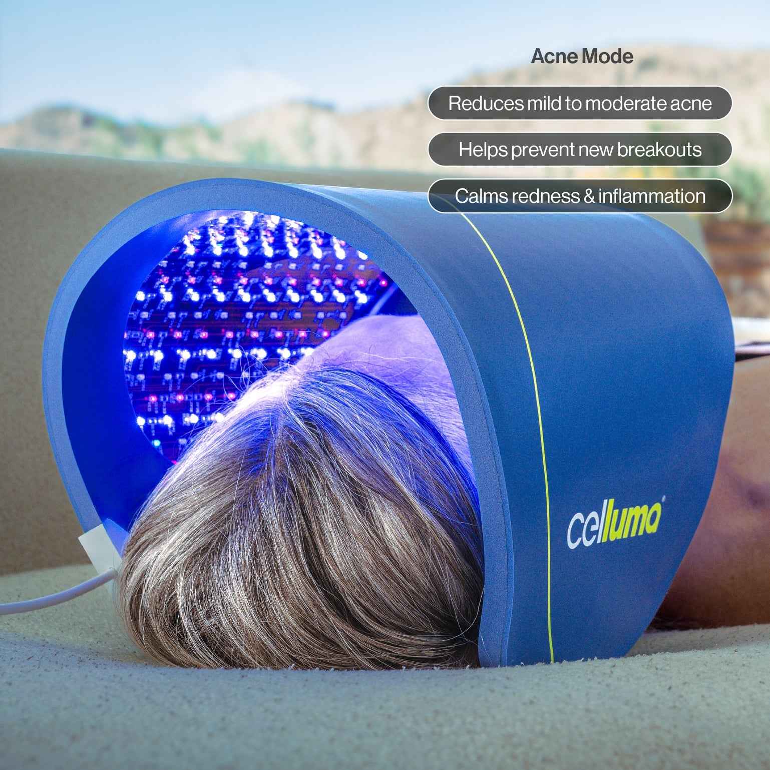 Woman applying Celluma Contour LED Red Light therapy to treat acne, reduce breakouts, and calm skin inflammation.
