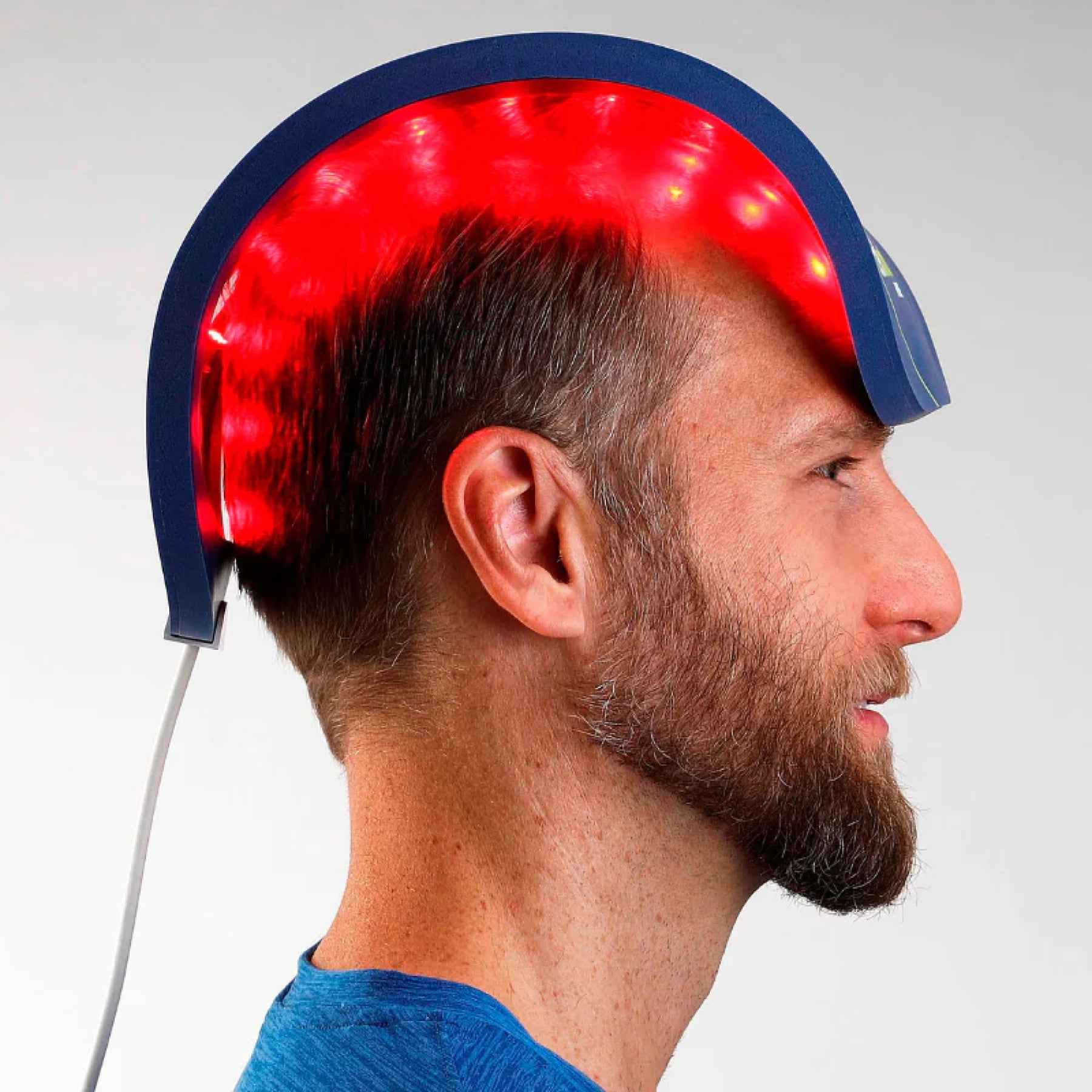 files/Celluma-Restore-red-light-therapy-for-hair-loss.jpg