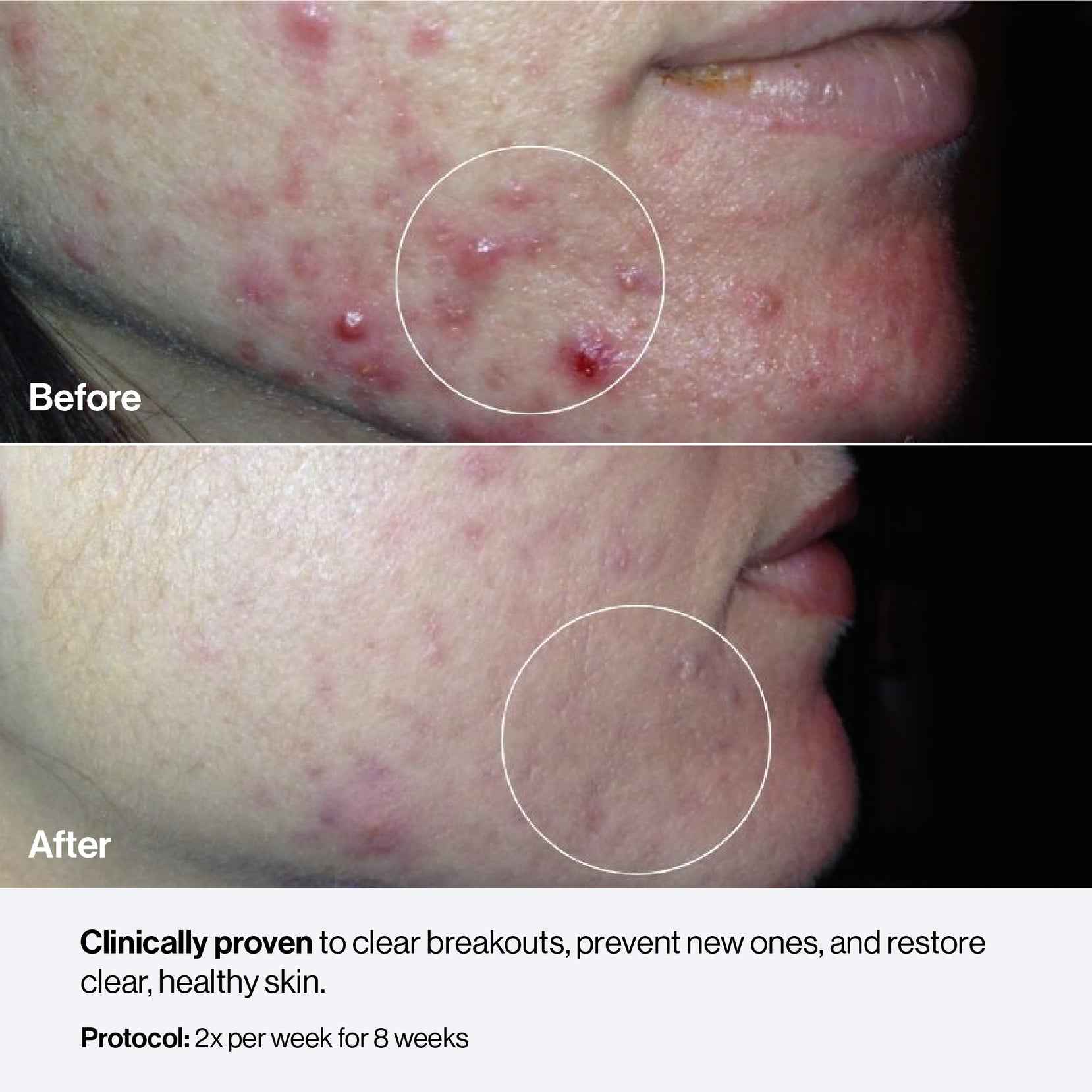 FDA-cleared Celluma NOVA LED red light therapy panel with hair growth, acne, anti-aging, pain, and contouring modes.