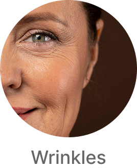 Close-up of a person's face with wrinkles, labeled 'Wrinkles'.